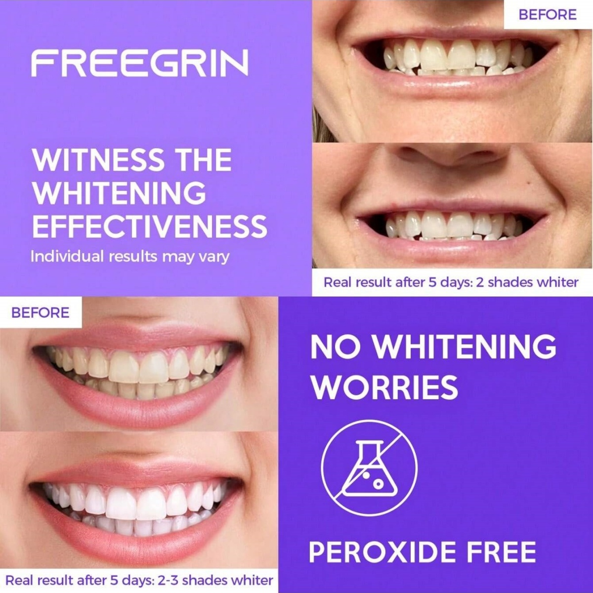 Deluxe Whitening Teeth Sticker – Home Fragrance Gel recenzja i cena